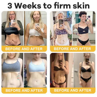 🎄𝑶𝒇𝒇𝒊𝒄𝒊𝒂𝒍 𝑺𝒕𝒐𝒓𝒆  | Hiskin® Botox Silk Body Oil Rediscover confidence with firmer, smoother, radiant skin
