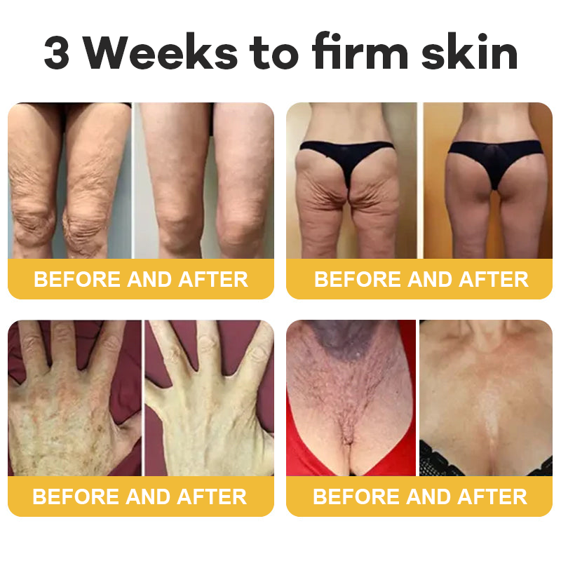 🎄𝑶𝒇𝒇𝒊𝒄𝒊𝒂𝒍 𝑺𝒕𝒐𝒓𝒆  | Hiskin® Botox Silk Body Oil Rediscover confidence with firmer, smoother, radiant skin
