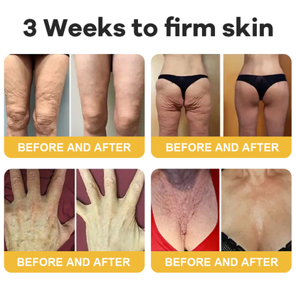 🎄𝑶𝒇𝒇𝒊𝒄𝒊𝒂𝒍 𝑺𝒕𝒐𝒓𝒆  | Hiskin® Botox Silk Body Oil Rediscover confidence with firmer, smoother, radiant skin