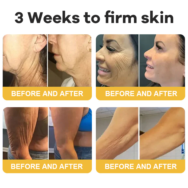 🎄𝑶𝒇𝒇𝒊𝒄𝒊𝒂𝒍 𝑺𝒕𝒐𝒓𝒆  | Hiskin® Botox Silk Body Oil Rediscover confidence with firmer, smoother, radiant skin