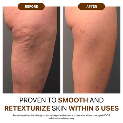 🎄𝑶𝒇𝒇𝒊𝒄𝒊𝒂𝒍 𝑺𝒕𝒐𝒓𝒆  | Hiskin® Botox Silk Body Oil Rediscover confidence with firmer, smoother, radiant skin