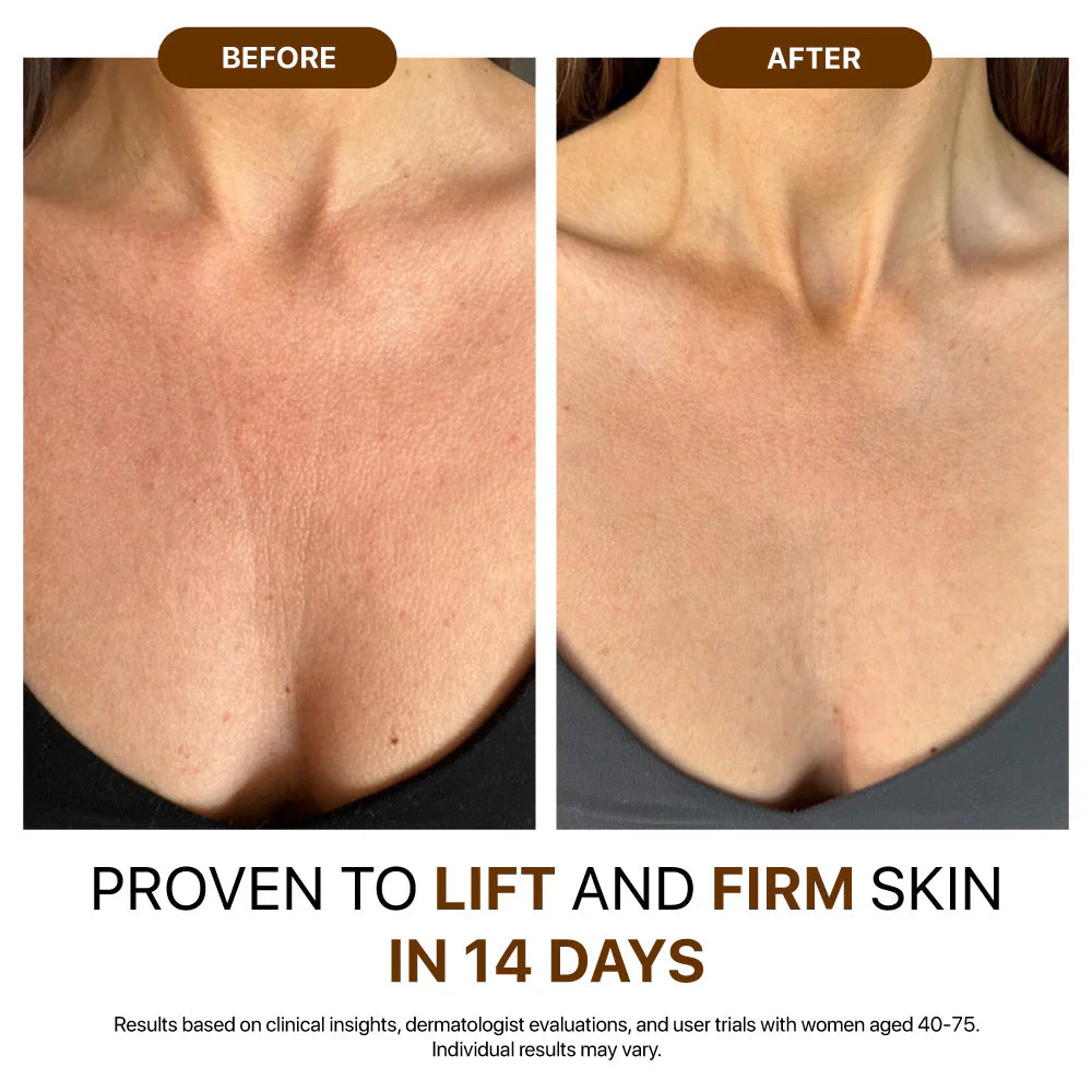 🎄𝑶𝒇𝒇𝒊𝒄𝒊𝒂𝒍 𝑺𝒕𝒐𝒓𝒆  | Hiskin® Botox Silk Body Oil Rediscover confidence with firmer, smoother, radiant skin