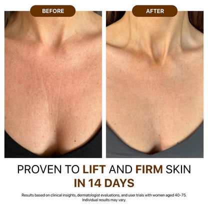 🎄𝑶𝒇𝒇𝒊𝒄𝒊𝒂𝒍 𝑺𝒕𝒐𝒓𝒆  | Hiskin® Botox Silk Body Oil Rediscover confidence with firmer, smoother, radiant skin