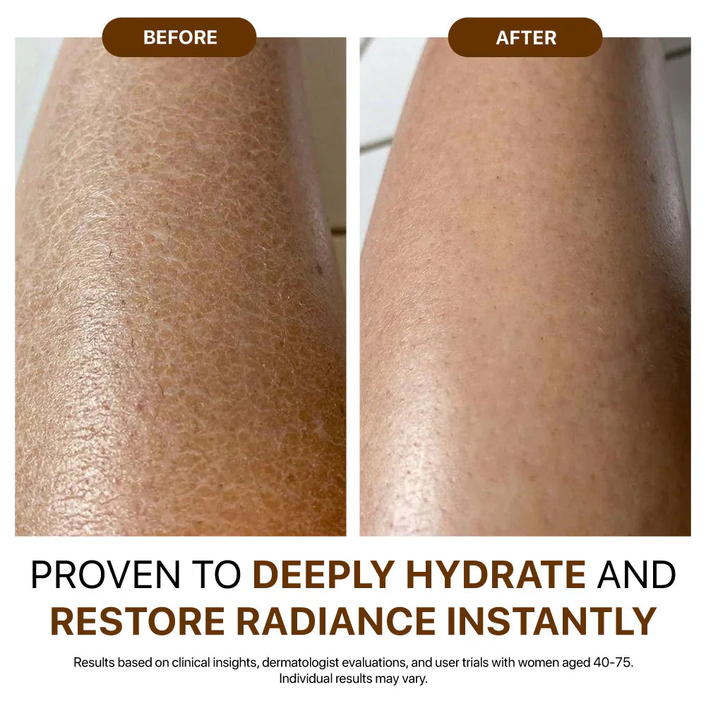 🎄𝑶𝒇𝒇𝒊𝒄𝒊𝒂𝒍 𝑺𝒕𝒐𝒓𝒆  | Hiskin® Botox Silk Body Oil Rediscover confidence with firmer, smoother, radiant skin